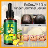 7 Day Ginger Germinal Oil Hair Nutrient Solution Hair Growth