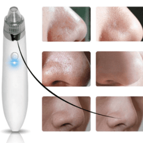 Facial Blackhead Remover Pore Cleaner Vacuum Peeling Dead Skin Acne remover Device