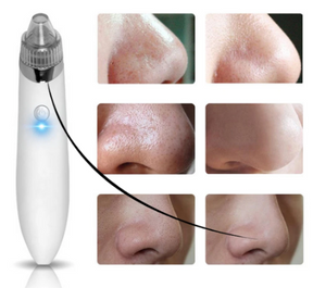 Facial Blackhead Remover Pore Cleaner Vacuum Peeling Dead Skin Acne remover Device